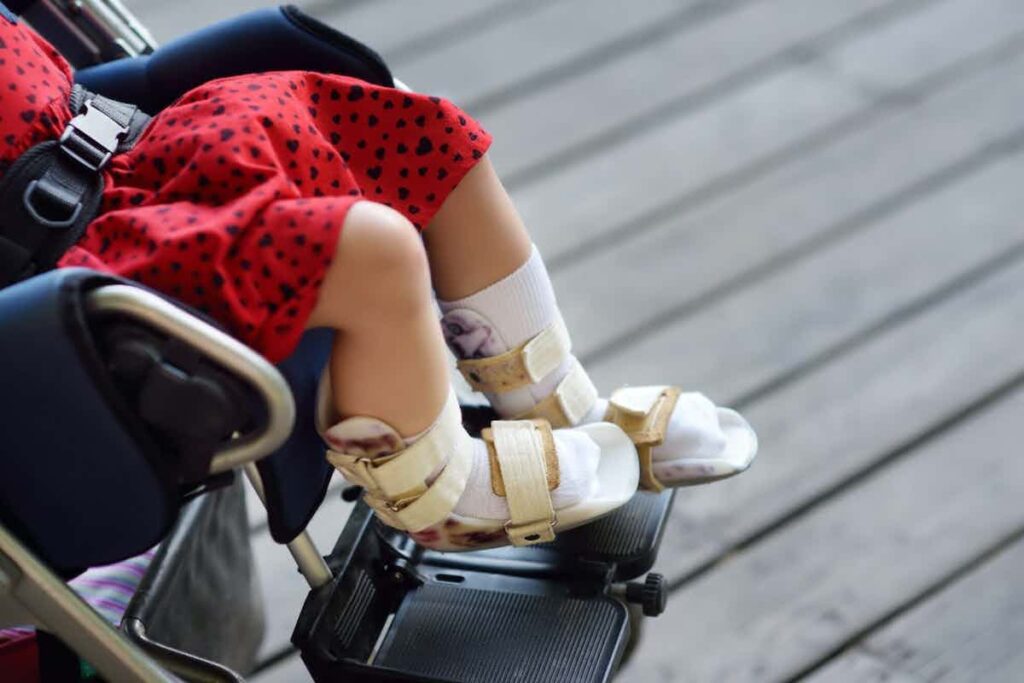 patient getting tested for Muscular Dystrophy vs Cerebral Palsy
